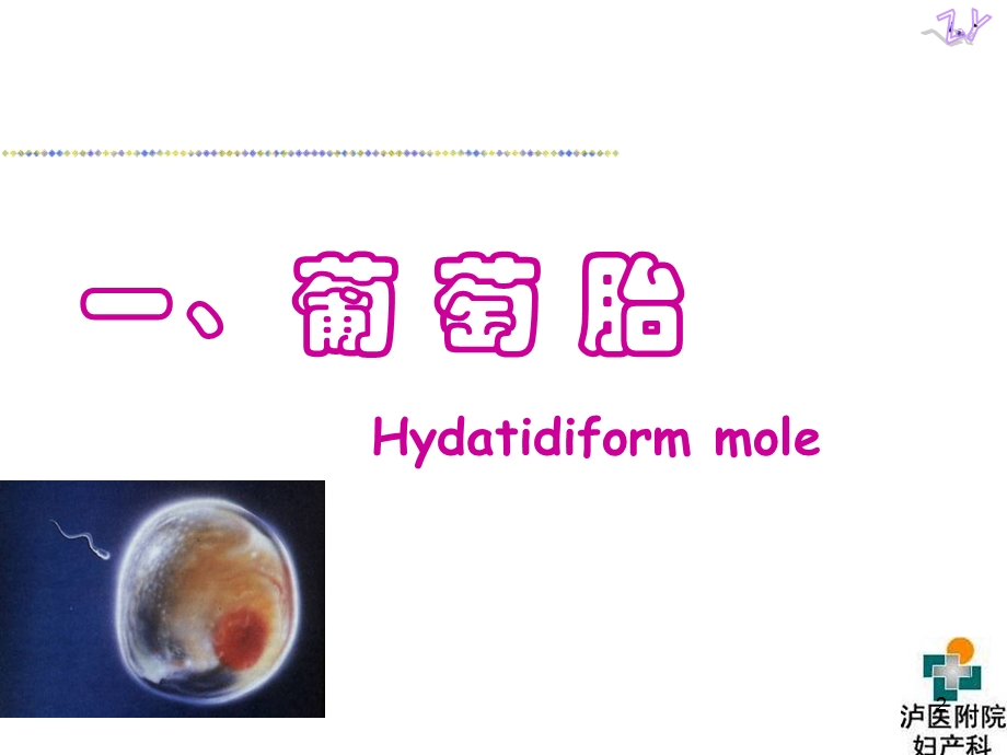 妇产科护理ppt课件_妊娠滋养细胞疾病.ppt_第2页