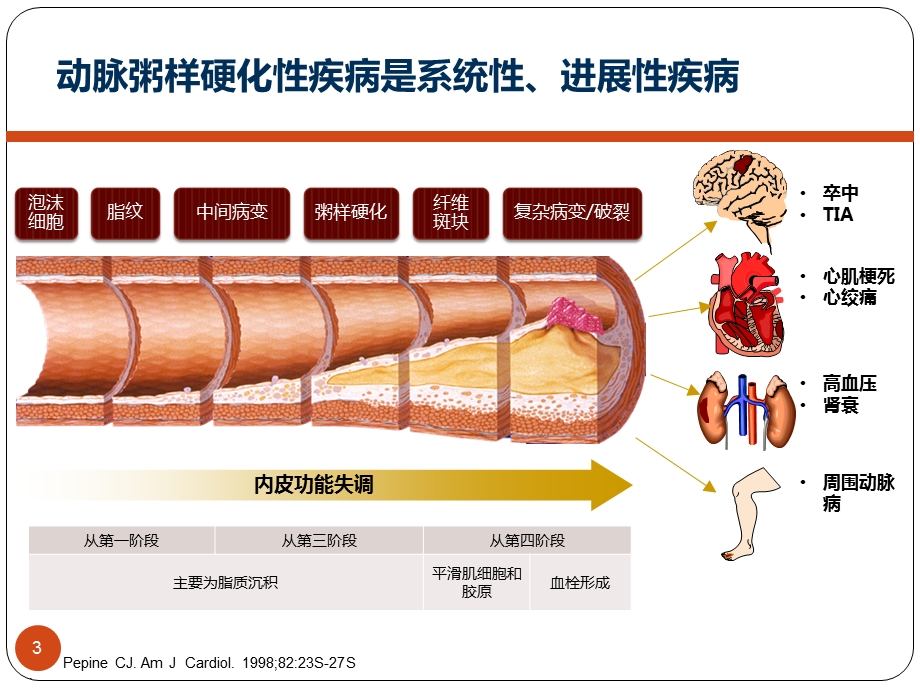 缺血性卒中防治新理念-以动脉粥样硬化为靶点课件.ppt_第3页