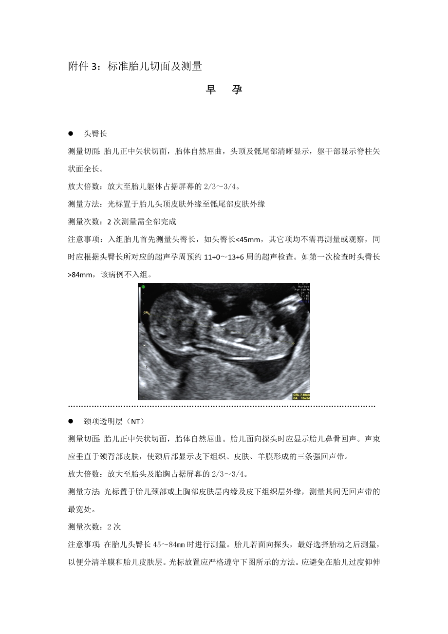 胎儿标准测量切面.doc_第1页