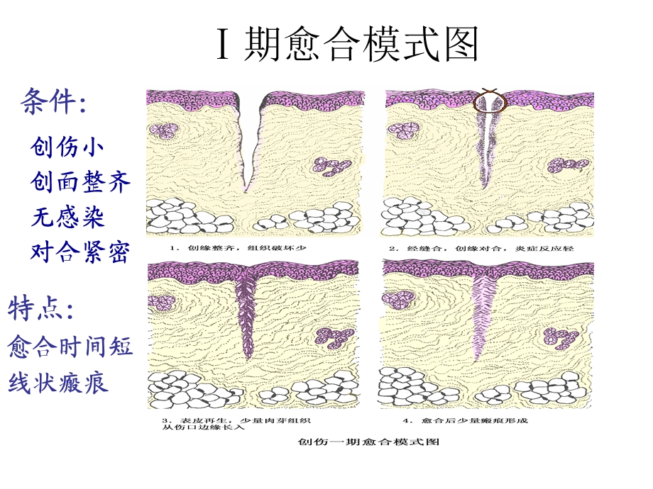 病理学ppt课件局部血液循环障碍.ppt_第3页