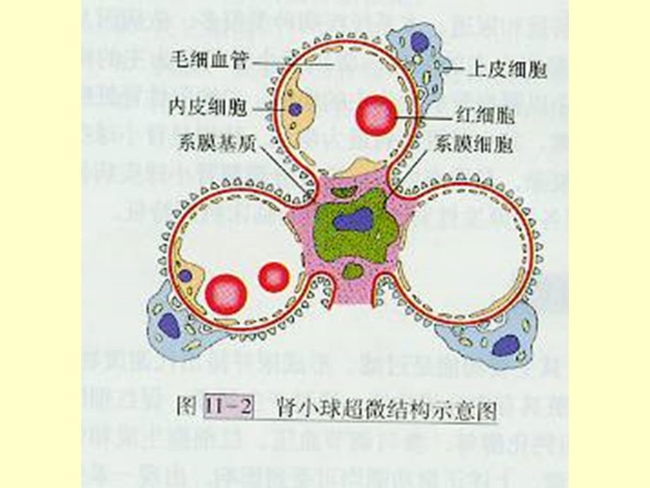 病理学ppt课件-泌尿系统疾病.ppt_第3页