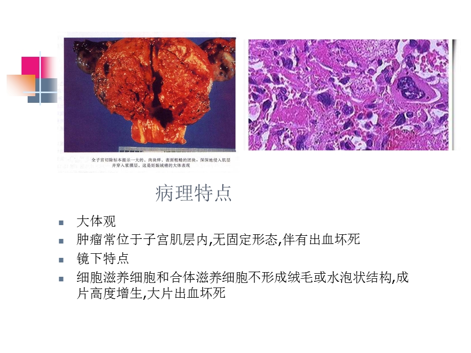 绒癌护理查房课件.ppt_第2页