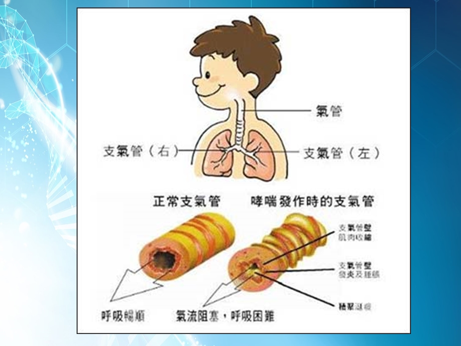 致命性哮喘课件.pptx_第3页