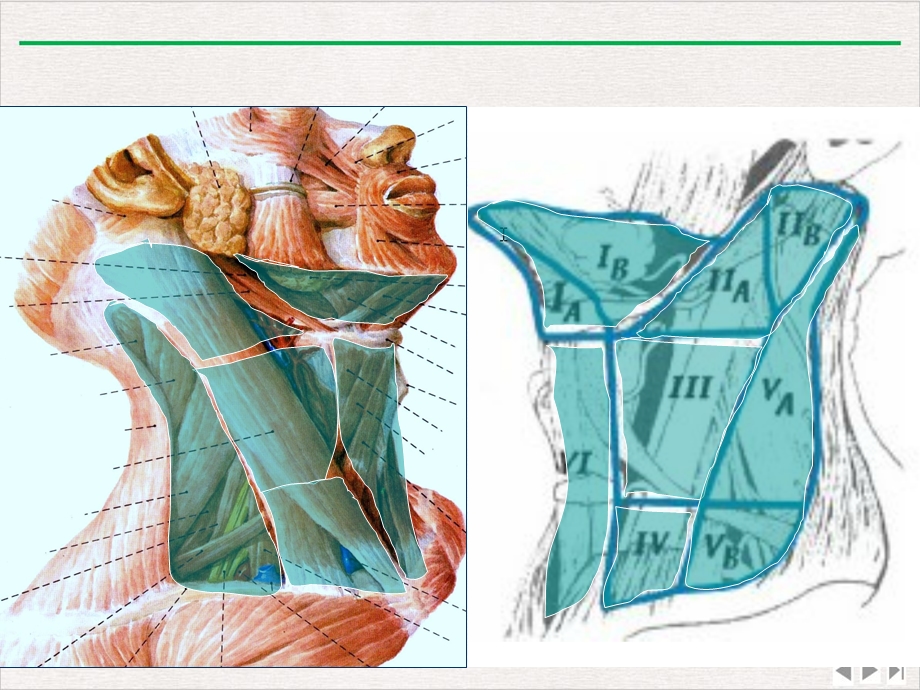 颈部淋巴结分组勾画幻灯课件.pptx_第2页