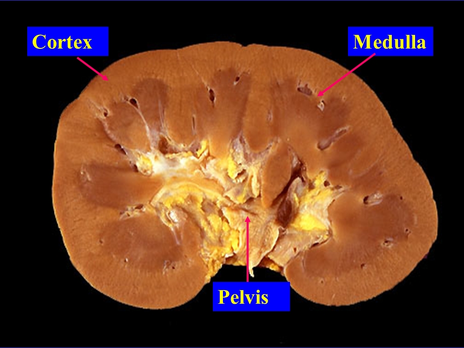 病理学ppt课件之泌尿系统疾病.ppt_第3页