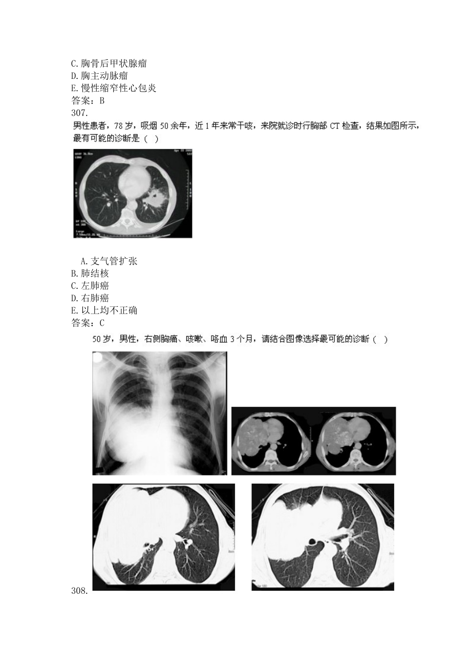 卫生高级职称(胸心外科)题库及答案(二)(过关必做).docx_第2页