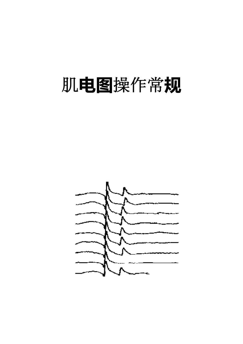 肌电图操作常规.doc_第1页