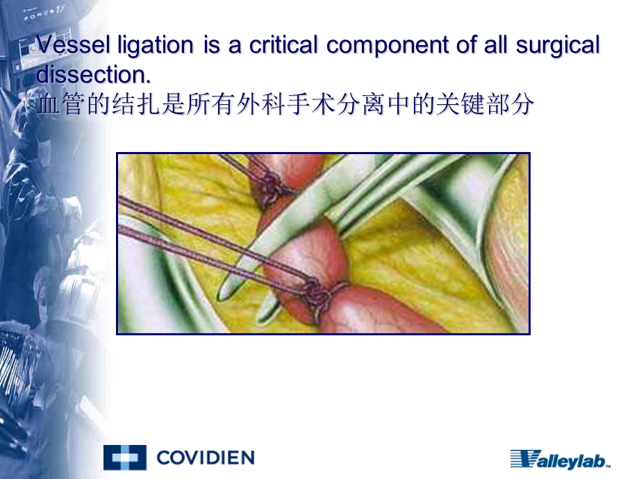 ligasuretm的临床应用文档资料.ppt_第3页