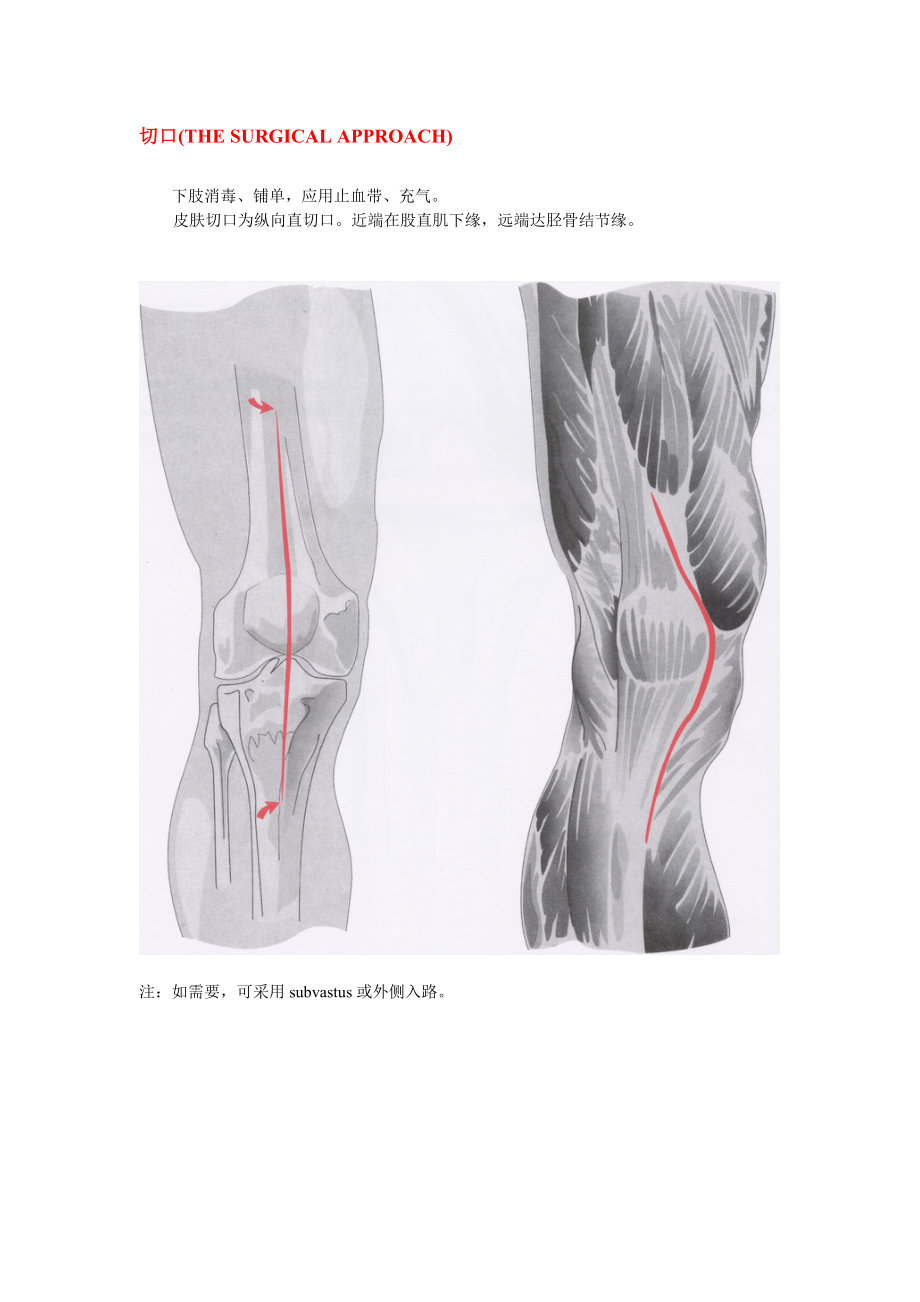 人工膝关节置换术手册(强生公司).doc_第3页