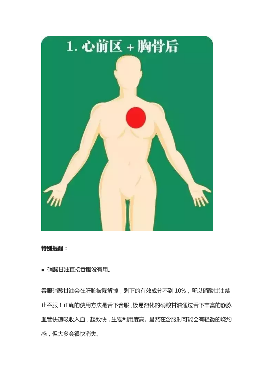 急性心梗的10个常见的疼痛部位及图解.docx_第2页