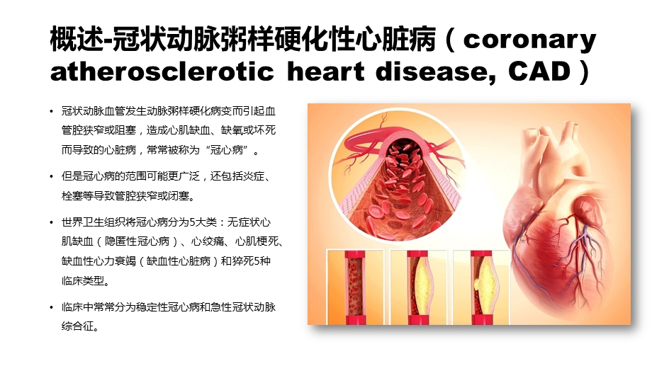 冠心病外科治疗白一帆.pptx_第2页