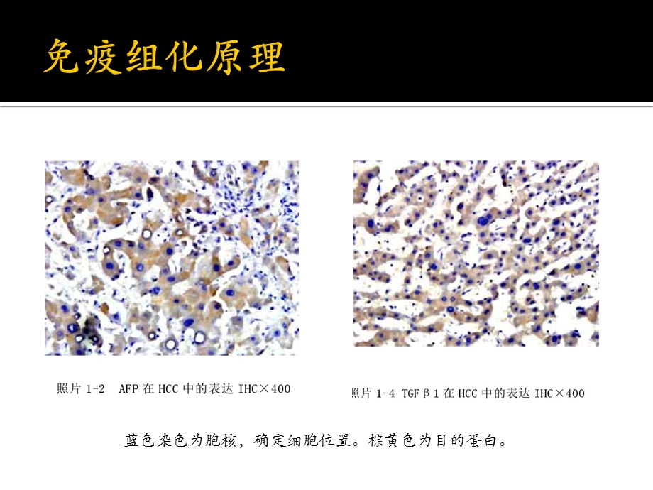 乳腺癌的免疫标志物.pptx_第3页