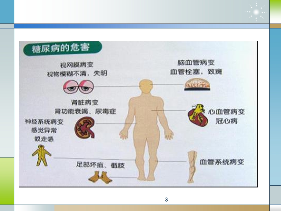 糖尿病与冠心病.pptx_第3页