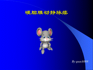 脑动脉瘘.ppt