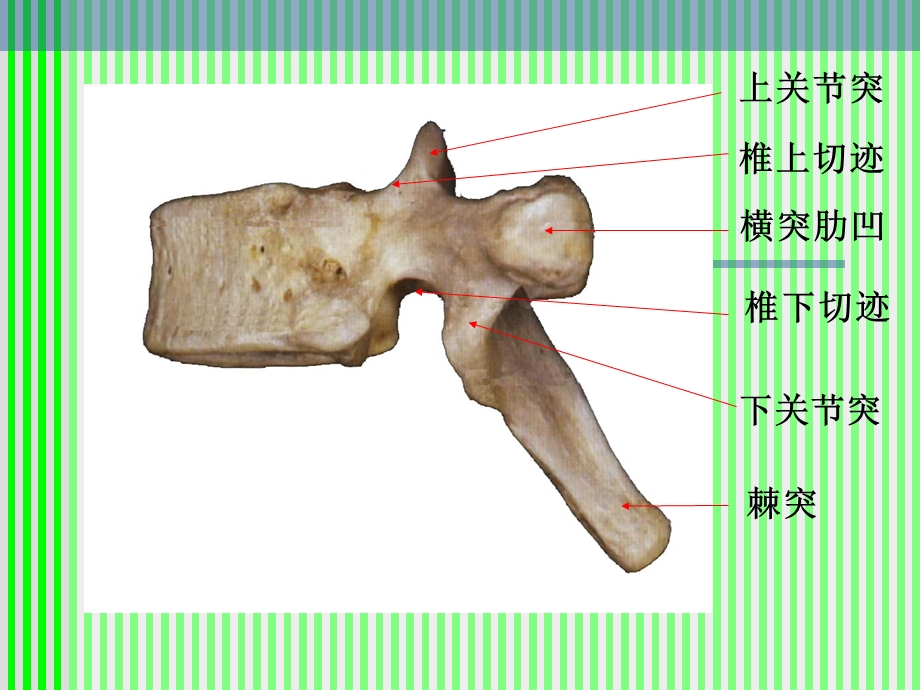 脊柱脊髓应用解剖课件.ppt_第3页