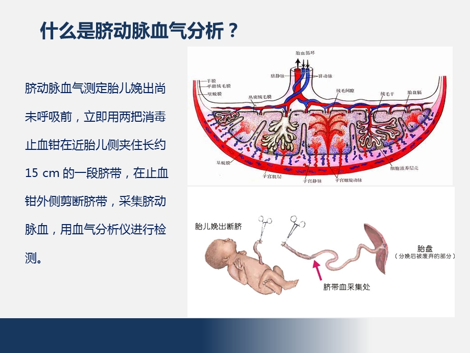 脐动脉血血气分析的临床应用.pptx_第2页