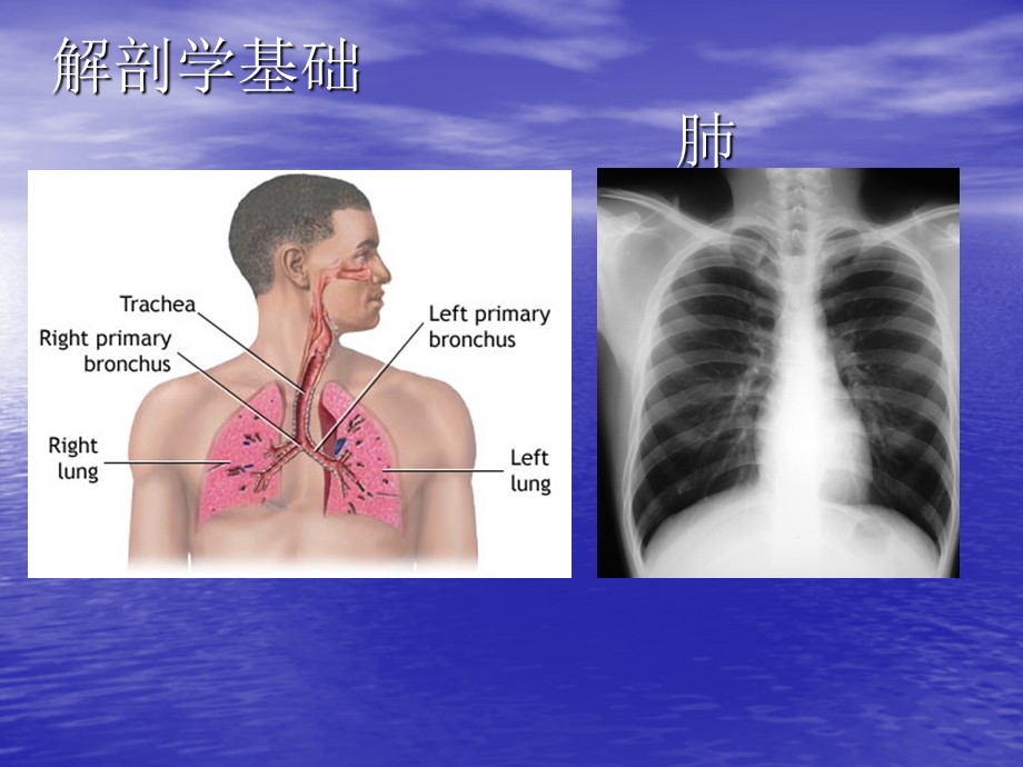 肺部超声PPT医学课件.pptx_第3页