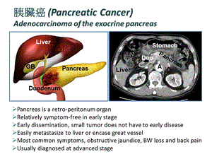 局部进展期胰腺癌治疗新进展CSCO年会文档资料.ppt