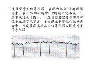 诊断课件心电图检查4文档资料.ppt