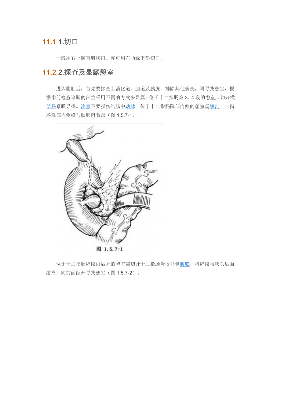 十二指肠憩室手术.doc_第3页