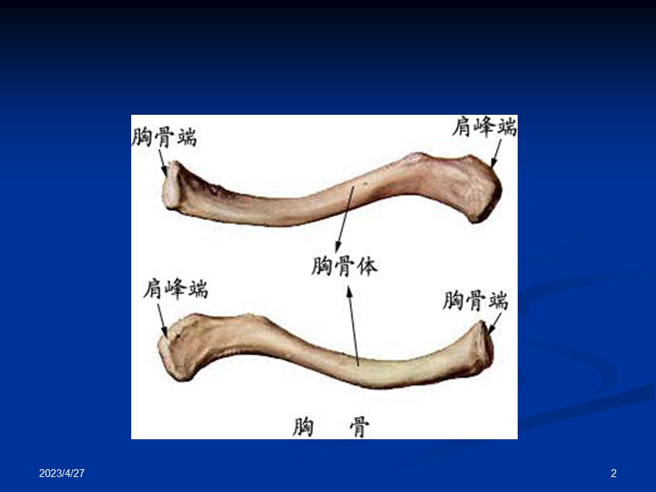 上肢骨关节损伤ppt课件PPT文档.ppt_第2页