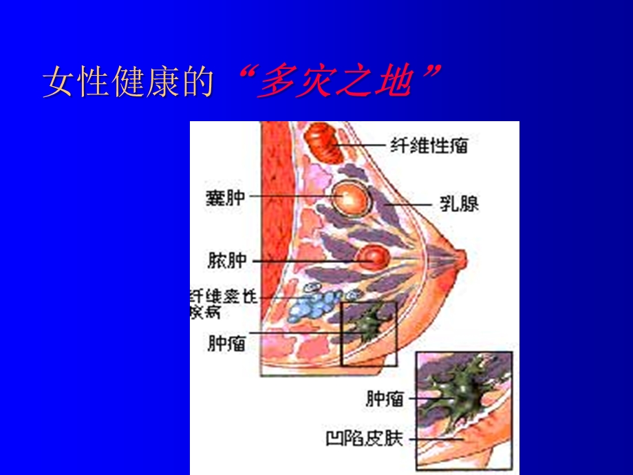 乳腺疾病的诊断与治疗精精选文档.ppt_第2页