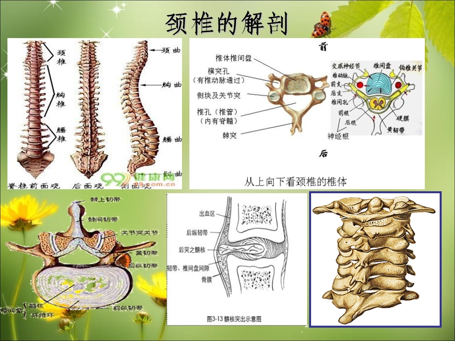 颈椎病的护理实习生讲座文档资料.ppt_第3页