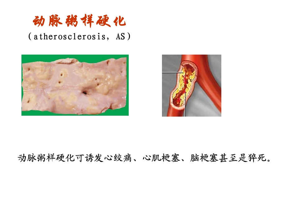 调血脂药和抗动脉粥样硬化药分析课件文档资料.ppt_第1页