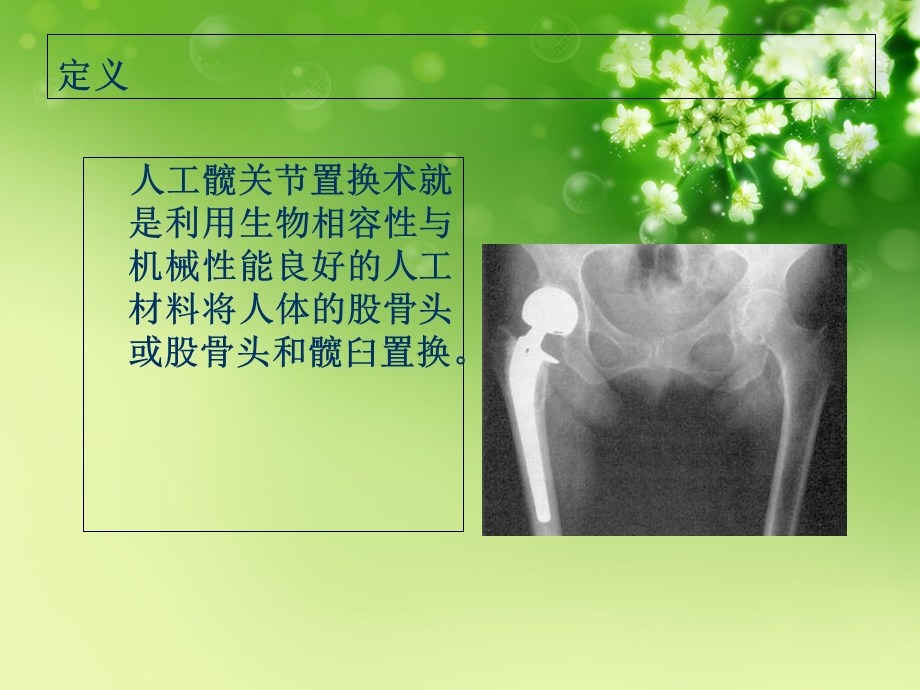 人工髋关节置换的护理ppt2PPT文档.ppt_第1页