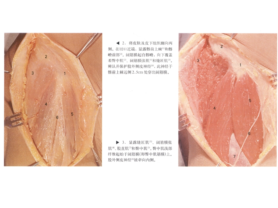 髋关节手术入路ppt课件文档资料.ppt_第2页