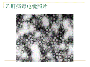 乙型肝炎病毒检验结果判断精选文档.ppt