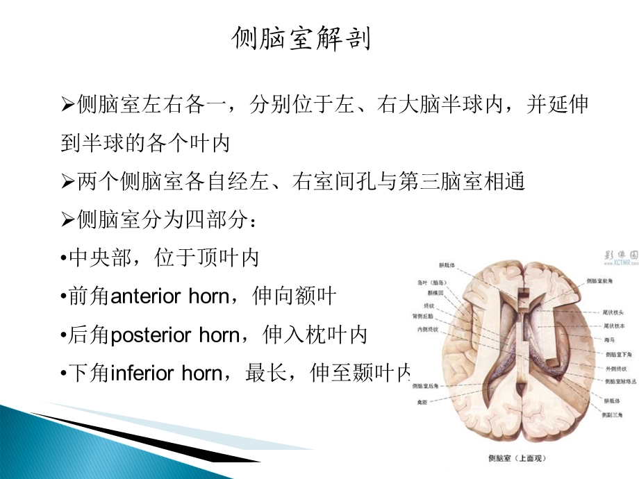 侧脑室肿瘤的诊断与鉴别文档资料.ppt_第2页