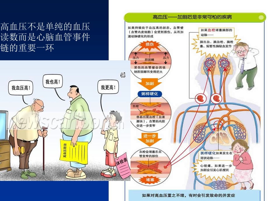 高血压的规范化治疗.pptx_第2页