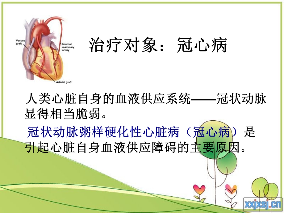 【医药健康】激光心肌血管重建术文档资料.ppt_第1页