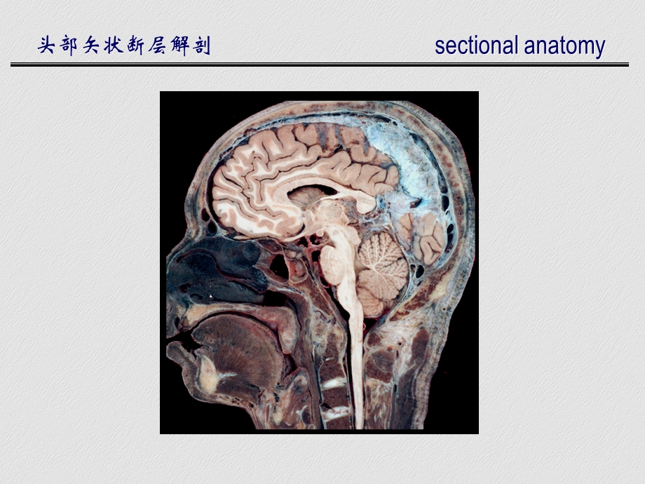 头部矢状断层解剖 文档资料.ppt_第3页