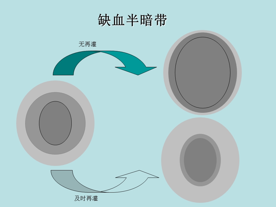 缺血性脑卒中急性期溶栓治疗进展文档资料.ppt_第3页