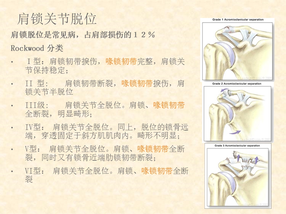 双ENDOBUTTON技术重建肩锁关节 PP课件文档资料.ppt_第3页