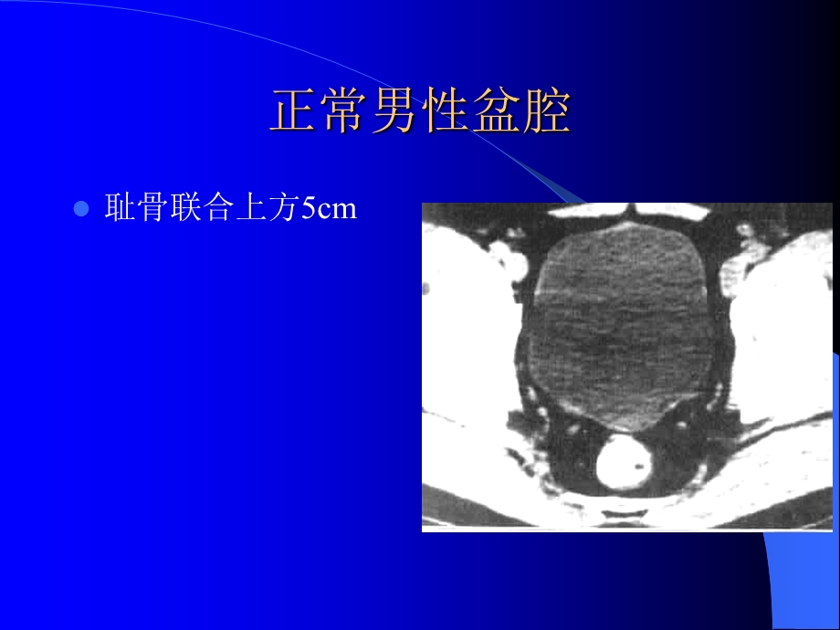 腹腔及腹膜后CT诊断2ppt课件文档资料.ppt_第3页