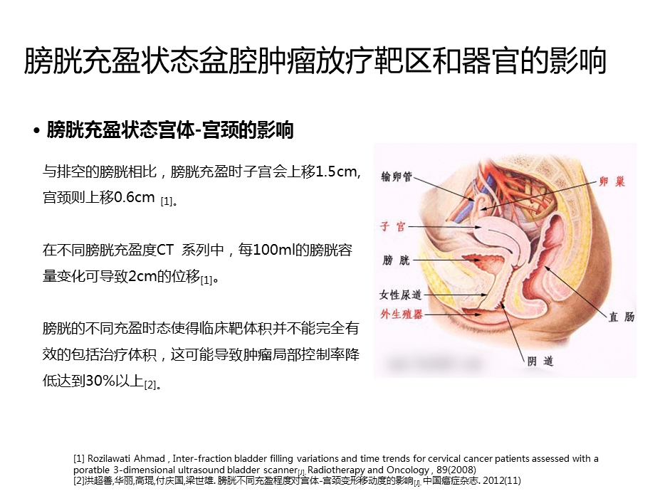 膀胱容量测量仪在盆腔肿瘤精准放疗上的应用ppt课件文档资料.ppt_第2页