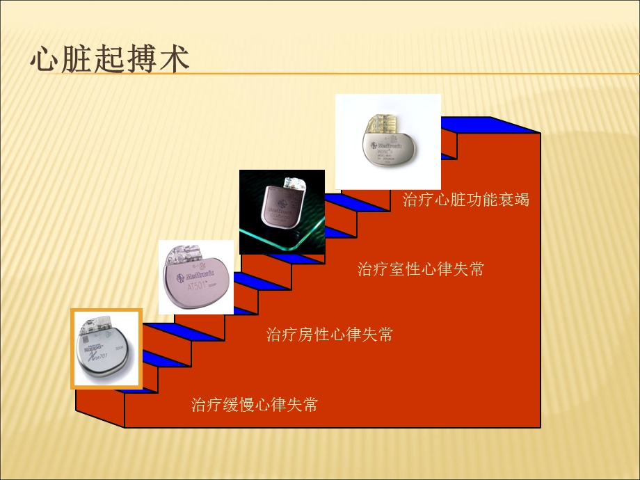 起搏器基础及护理ppt课件文档资料.ppt_第2页