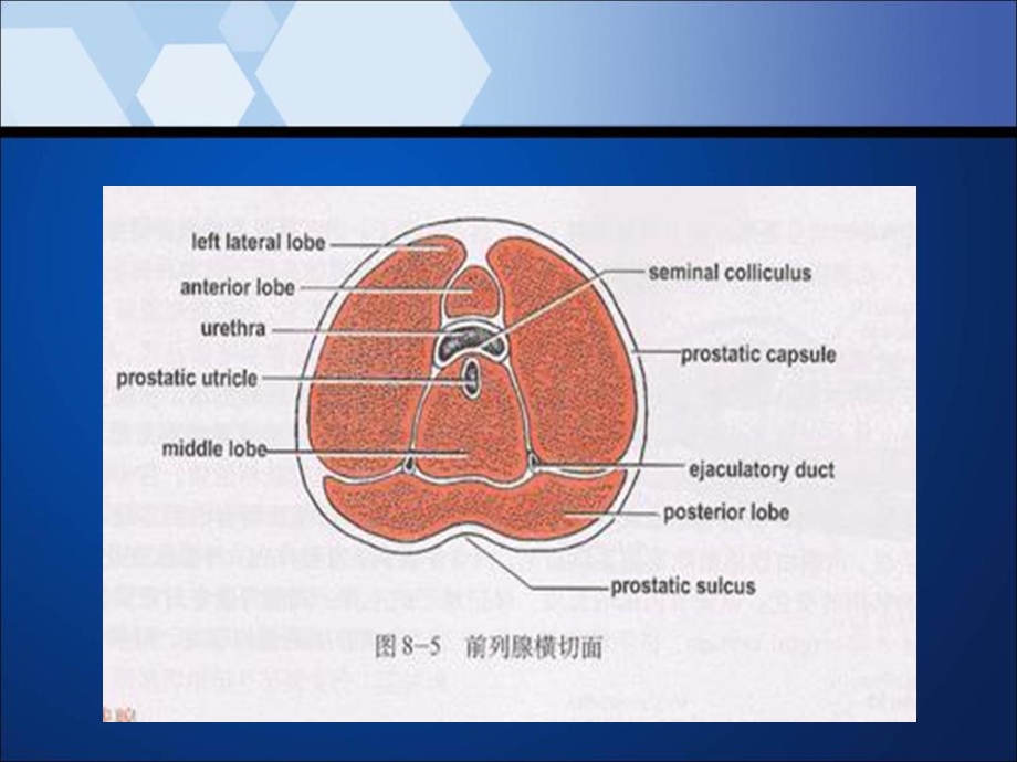 前列腺增生与前列腺癌的磁共振诊断及波谱分析文档资料.ppt_第3页