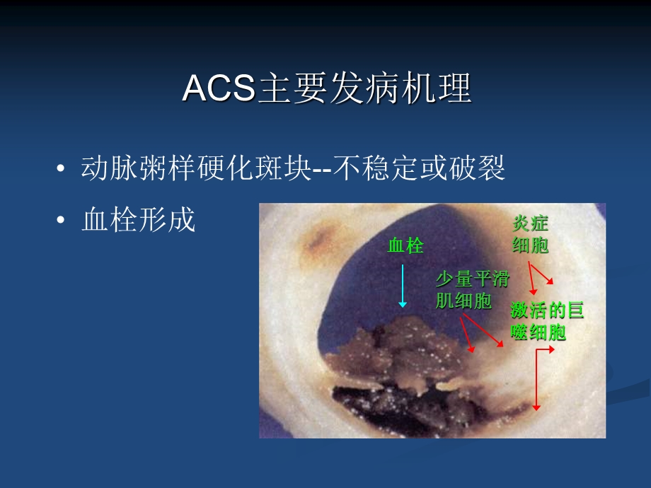 抗栓治疗中出血风险的预测与处理文档资料.ppt_第1页