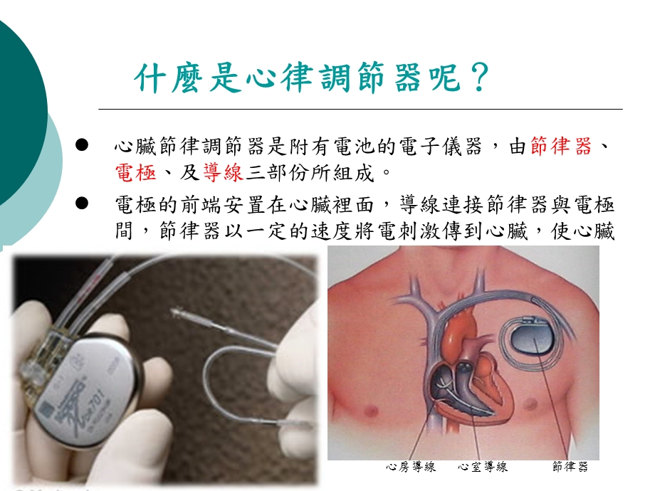 【医药健康】心脏内科心律调节器卫教精选文档.ppt_第1页