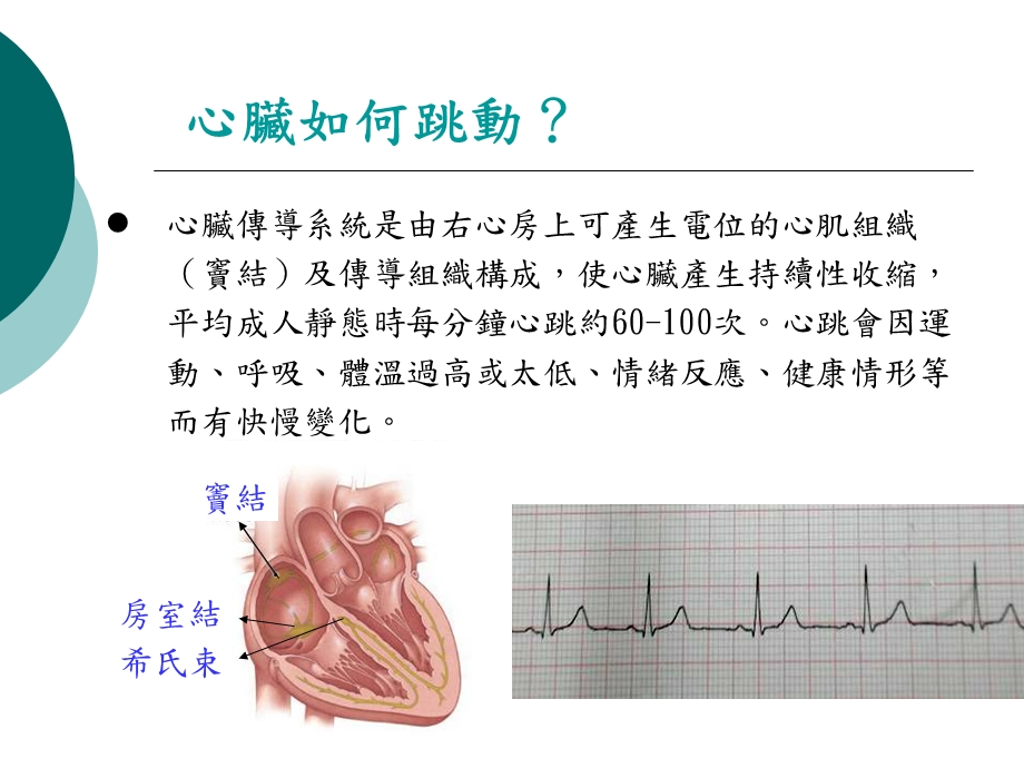 【医药健康】心脏内科心律调节器卫教精选文档.ppt_第3页