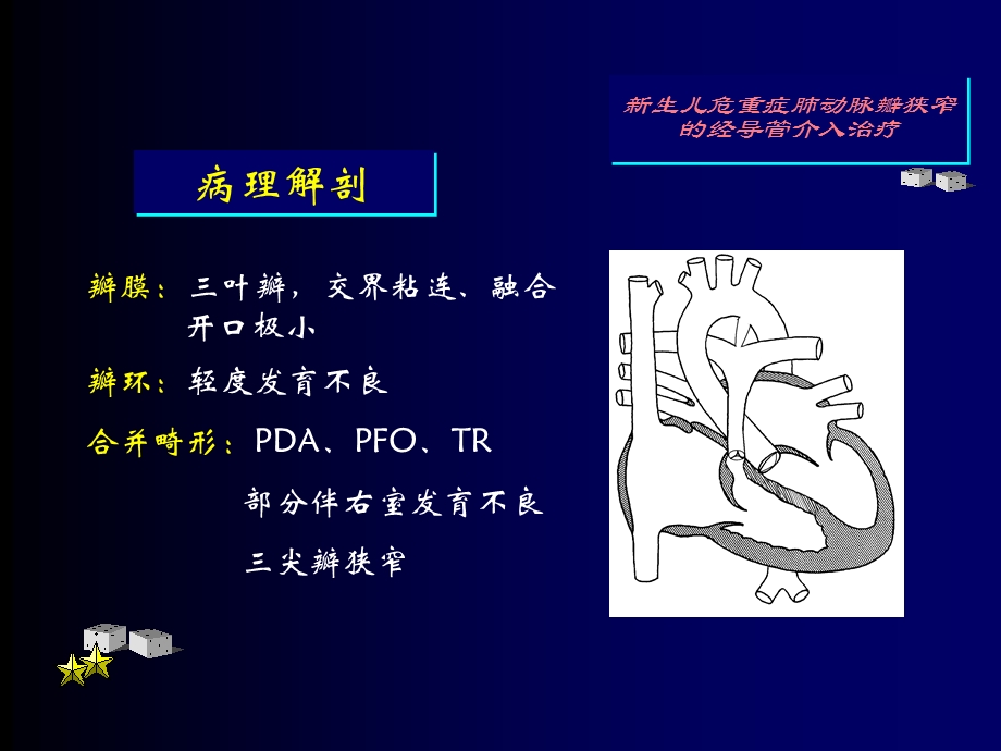 新生儿危重症肺动脉瓣狭窄的经导管介入治疗文档资料.ppt_第1页