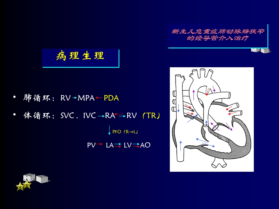 新生儿危重症肺动脉瓣狭窄的经导管介入治疗文档资料.ppt_第2页