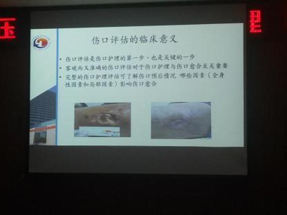 伤口管理精选文档.ppt_第3页