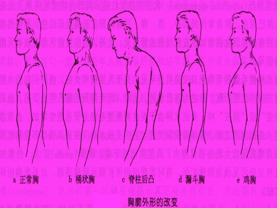 诊断学基础疾病概要胸部检查文档资料.ppt_第2页