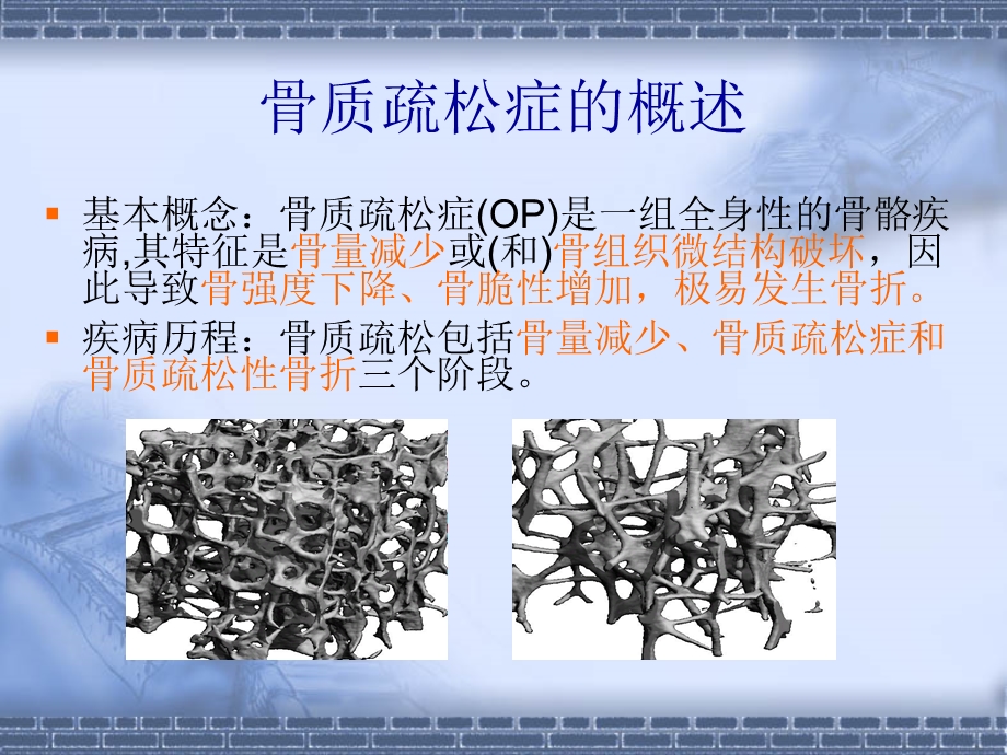 骨质疏松症康复湖南省马王堆疗养院唐建明文档资料.ppt_第1页