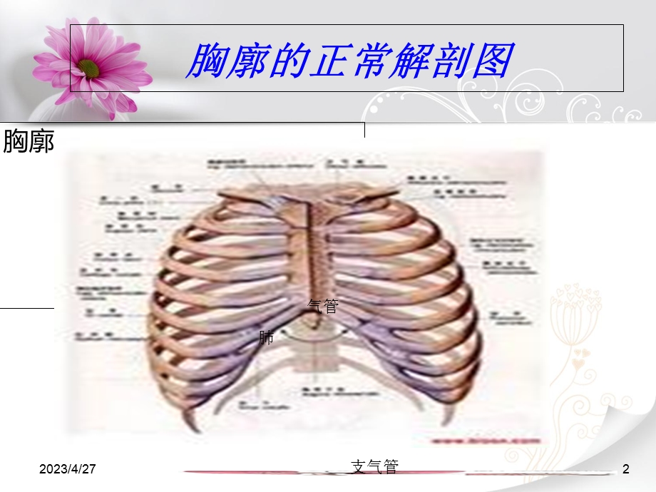 多发伤的护理PPT课件文档资料.ppt_第2页